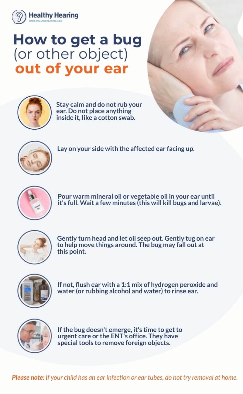 Step-by-step instructions on how to remove a bug from your ear. 