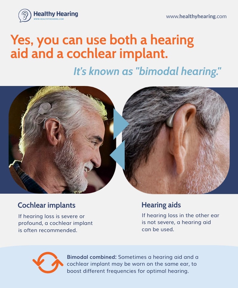 An infographic showing a hearing aid and a cochlear implant for bimodal hearing.