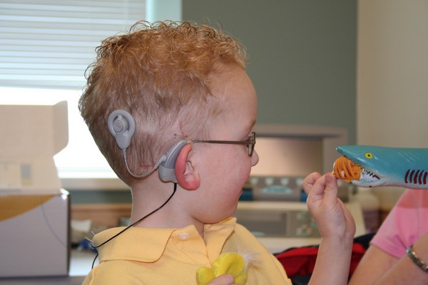 toddler wearing a cochlear implant