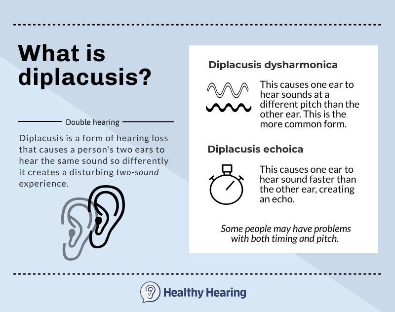 Infographic showing types of diplacusis.
