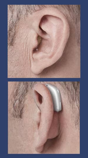 The two main types of hearing aids.