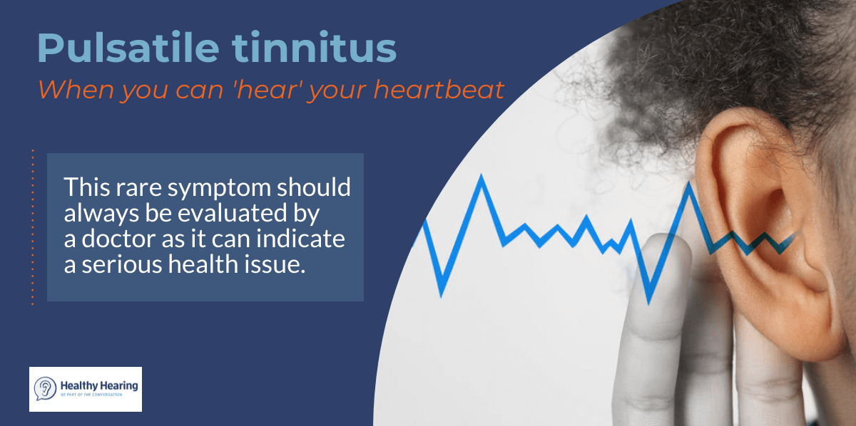 An infographic stating that pulsatile tinnitus should always be medically evaluated. 